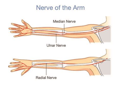 median nerve entrapment symptoms